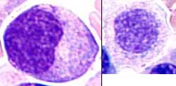 Myelocyte