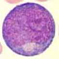 Metamyelocyte